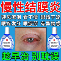 红霉素滴眼液氯替泼诺混悬滴眼液结膜炎角膜炎治疗眼睑球结膜炎眼