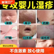 湿疹膏婴儿专用儿童宝宝湿疹口水疹无激素干性保湿面霜身体乳抑菌